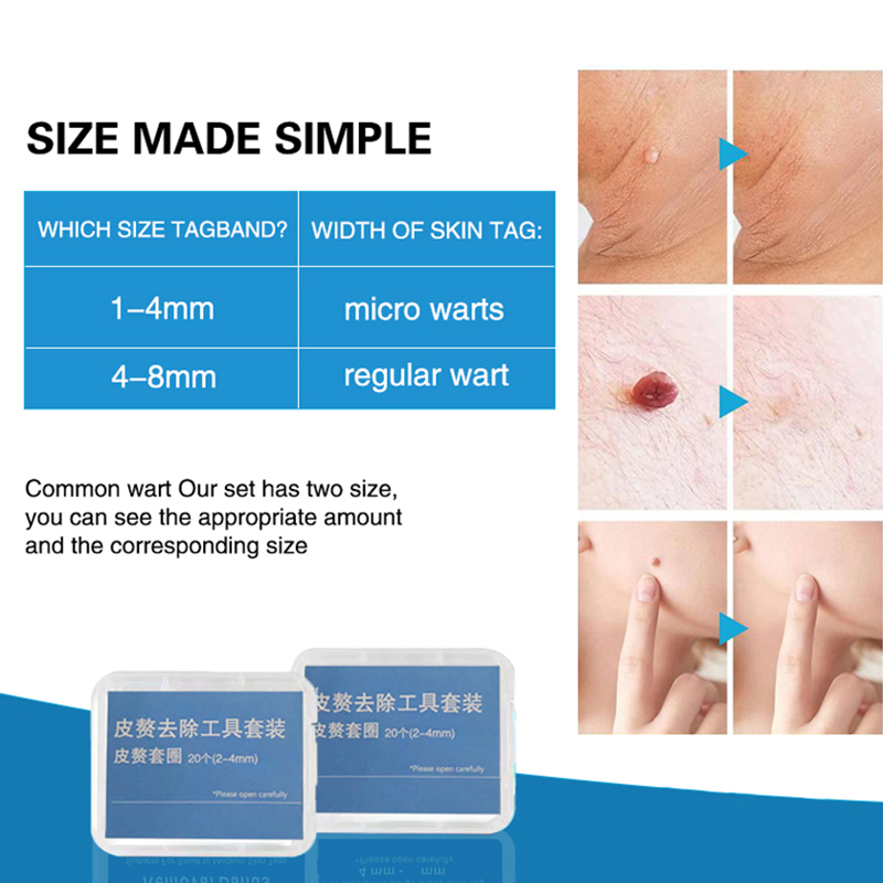 20pcs/Box Flesh Nevus Removal  - Power Tools Total ulasan dan harga